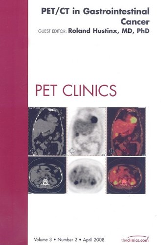 PET/CT in Gastrointestinal Cancer, An Issue of PET Clinics