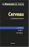 Cerveau : Les 100 principaux diagnostics