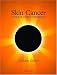 Skin Cancer: A Practical Guide to Surgical Management