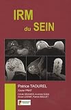 IRM du Sein