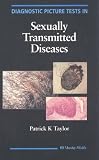 Diagnostic Picture Tests in Sexually Transmitted Diseases