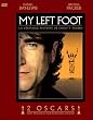 My left foot