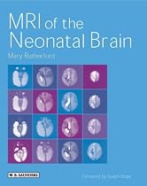 MRI of the Neonatal Brain