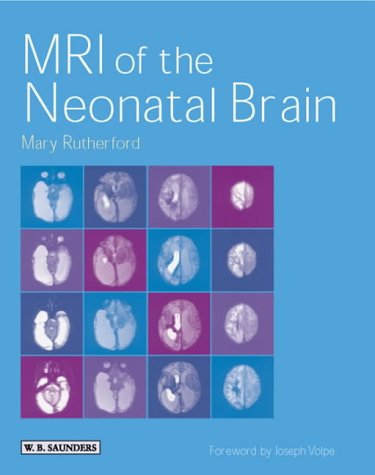 MRI of the Neonatal Brain