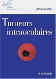 Tumeurs intraoculaires