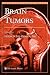 Brain Tumors (Contemporary Cancer Research)