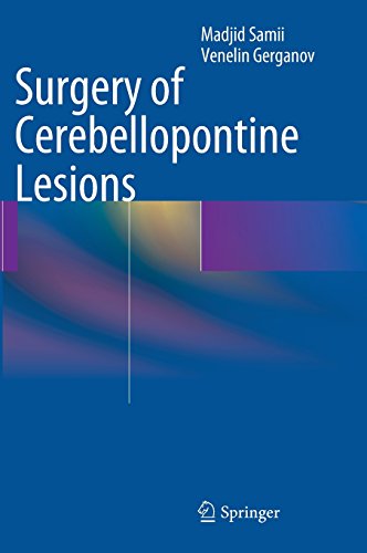 surgery of cerebellopontine lesions