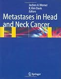 Metastases in Head and Neck Cancer