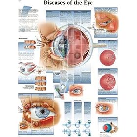 Diseases of the Eye Chart