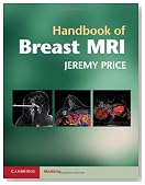 Handbook of Breast MRI