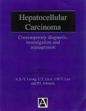 Hepatocellular Carcinoma: Diagnosis, Investigation and Management