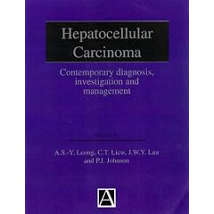 Hepatocellular Carcinoma: Diagnosis, Investigation and Management
