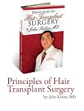 Principles of Hair Transplant Surgery, Patient's Handbook