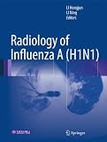 Radiology of influenza A (H1N1)