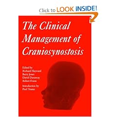Clinical Management of Craniosynostosis (Clinics in Developmental Medicine) by Richard Hayward, Barry Jones and David Dunaway