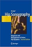 Hip Sonography: Diagnosis and Management of Infant Hip Dysplasia