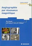 Angiographie par r�sonance magn�tique