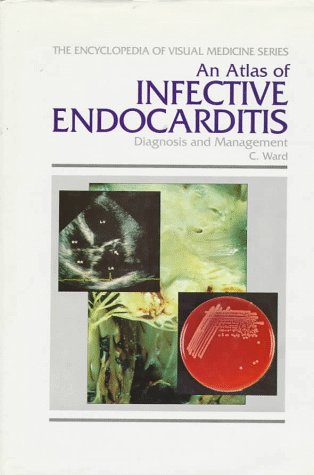 Endocarditis