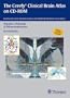 The Electronic Clinical Brain Atlas: Multiplanar Navigation of the Human Brain (Windows/Macintosh Cd-Rom)