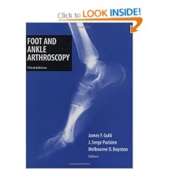 Foot and Ankle Arthroscopy