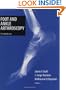 Foot and Ankle Arthroscopy