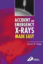 Accident and Emergency X-Rays Made Easy
