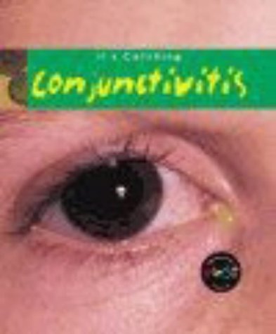 Conjunctivitis