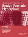 Books : Therapeutic Treatment for Benign Prostatic Hyperplasia