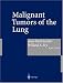 Malignant Tumors of the Lung: Evidence-based Management