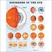 Disorders of the Eye Anatomical Chart