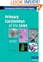 Primary Carcinomas of the Liver (Contemporary Issues in Cancer Imaging)