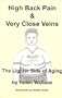 High Back Pain and Very Close Veins