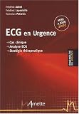 ECG en Urgence : Cas clinique Analyse ECG Stratégie thérapeutique