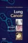 Lung Cancer: Dana-Farber Cancer Institute Handbook, 1e (Dana-Farber Cancer Institute Handbooks)