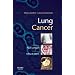 Lung Cancer: Dana-Farber Cancer Institute Handbook (Dana-Farber Cancer Institute Handbooks)