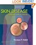 Skin Disease: Diagnosis and Treatment