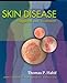 Skin Disease: Diagnosis and Treatment