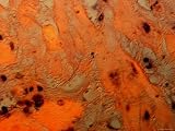 Endometrium with Decidua X40 Photomicrograph Photographic Poster Print, 32x24