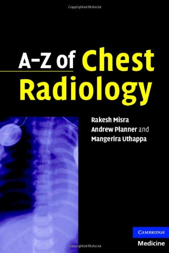 Textbook - A-Z of Chest Radiology
