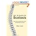 Help, My Daughter Has Scoliosis