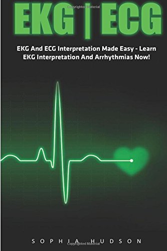 Ekg | Ecg: EKG And ECG Interpretation Made Easy - Learn EKG Interpretation And Arrhythmias Now! (EKG Book, ECG, Medical ebooks)