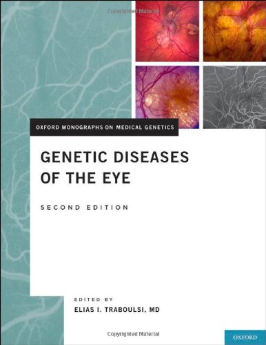 genetic diseases of the eye oxford monographs on medical genetics