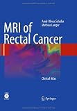 MRI of Rectal Cancer: Clinical Atlas
