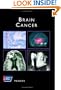 American Cancer Society Atlas of Clinical Oncology: Brain Cancer (Book with CD-ROM)