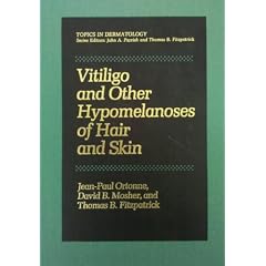 Vitiligo and Other Hypomelanoses of Hair and Skin (Topics in Dermatology) by Jean-Paul Ortonne