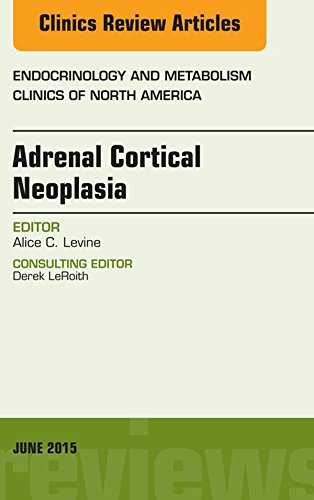 Adrenal Cortical Neoplasia, An Issue of Endocrinology and Metabolism Clinics of North America, (The Clinics: Internal Medicine)