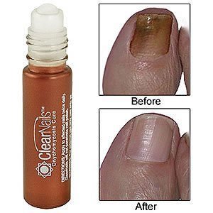 Clear Nails Antifungal Organic Stain Remover