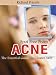 Spot Free From Acne: The 7 Steps To Success - How To Treat Acne,Best Remedies, Skin Care Tips, Treatments Spot Free From Acne: The 7 Steps To Success - How To Treat Acne,Best Remedies, Skin Care Tips, Treatments
