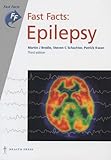 Epilepsy