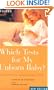 Which Tests for My Unborn Baby: Ultrasound and Other Prenatal Tests